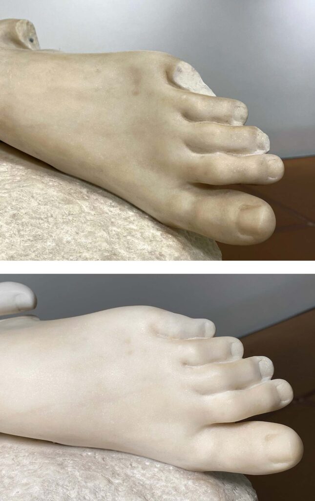 Left foot of mother before and after restoration