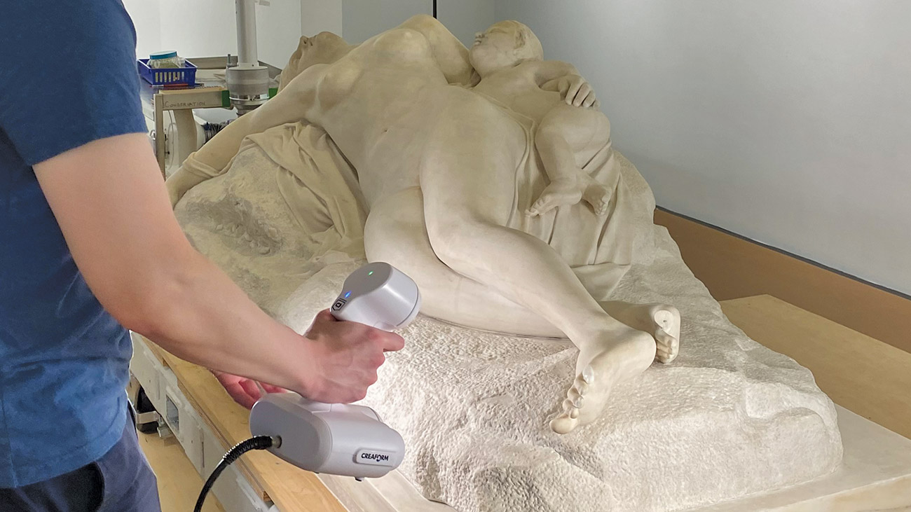 Replacing Missing Fingers and Toes with 3D Printing Technology
